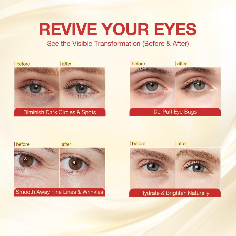 GONIM salmon DNA PDRN patches demonstrating deep hydration near the eye area.