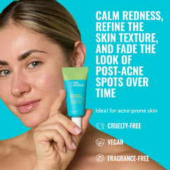 Good Molecules 10% Azelaic Acid Treatment cream swirl gentle brightening