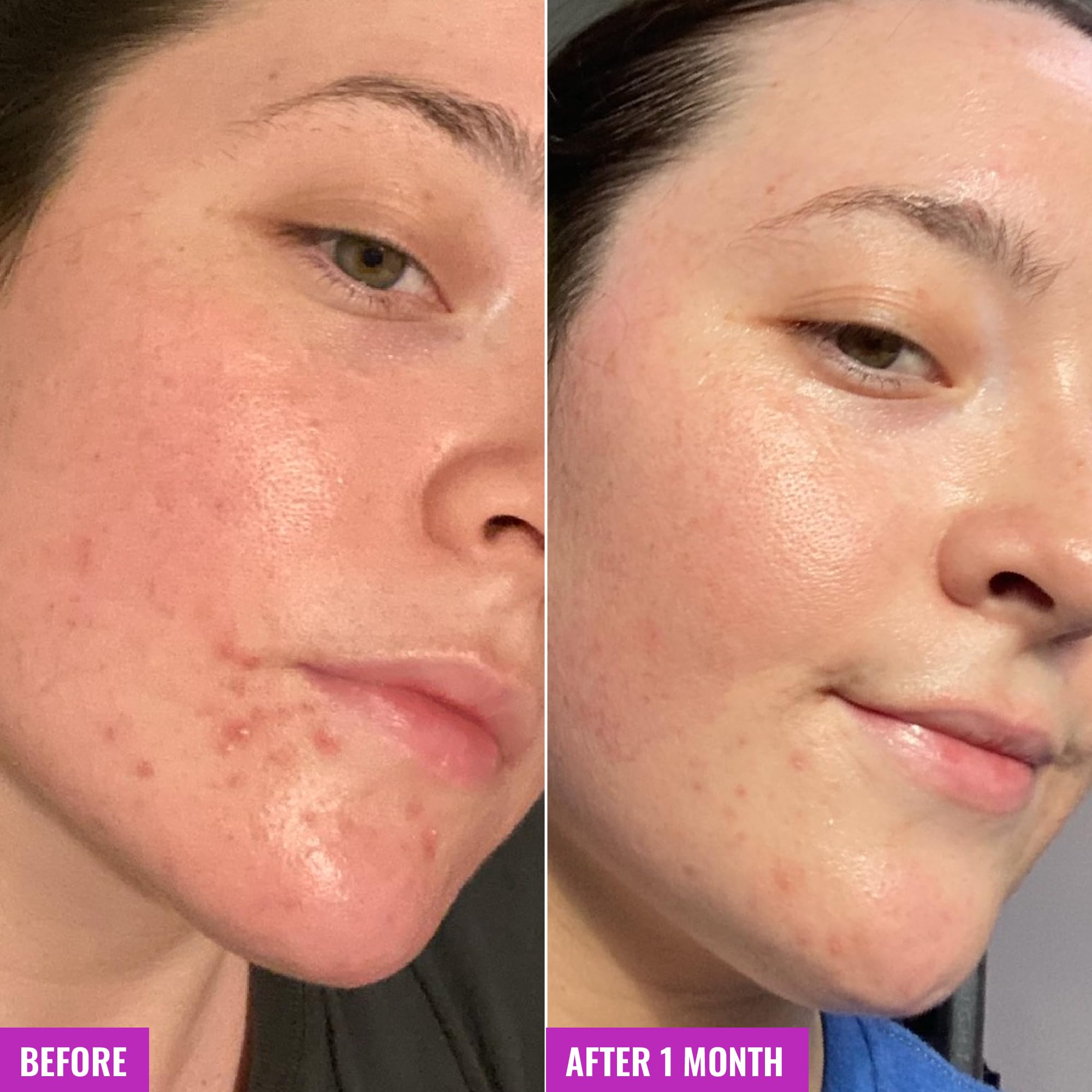 Good Molecules Clarify and Cleanse Bar kaolin clay balances oil for a calmer complexion.