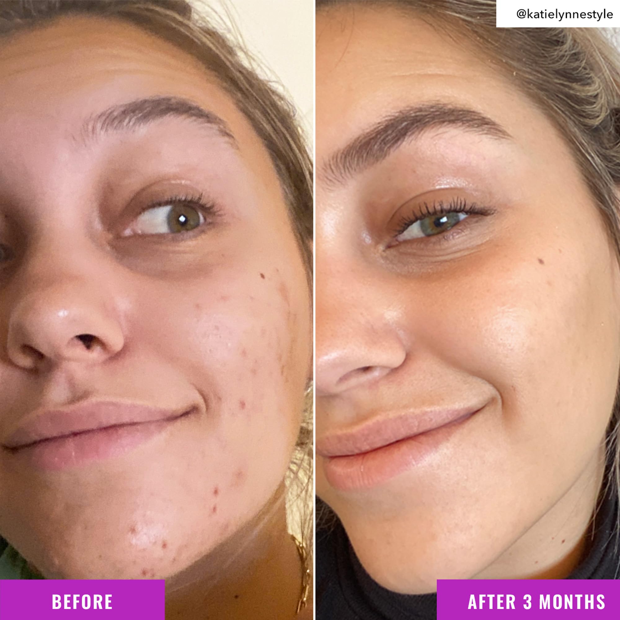 Good Molecules Niacinamide Brightening Toner ingredients-list feature niacinamide and arbutin.