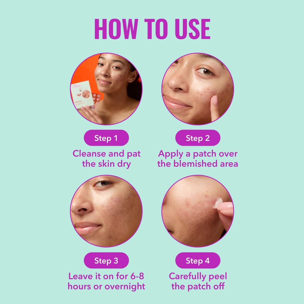 Good Molecules patches stay in place overnight without sticky residue.