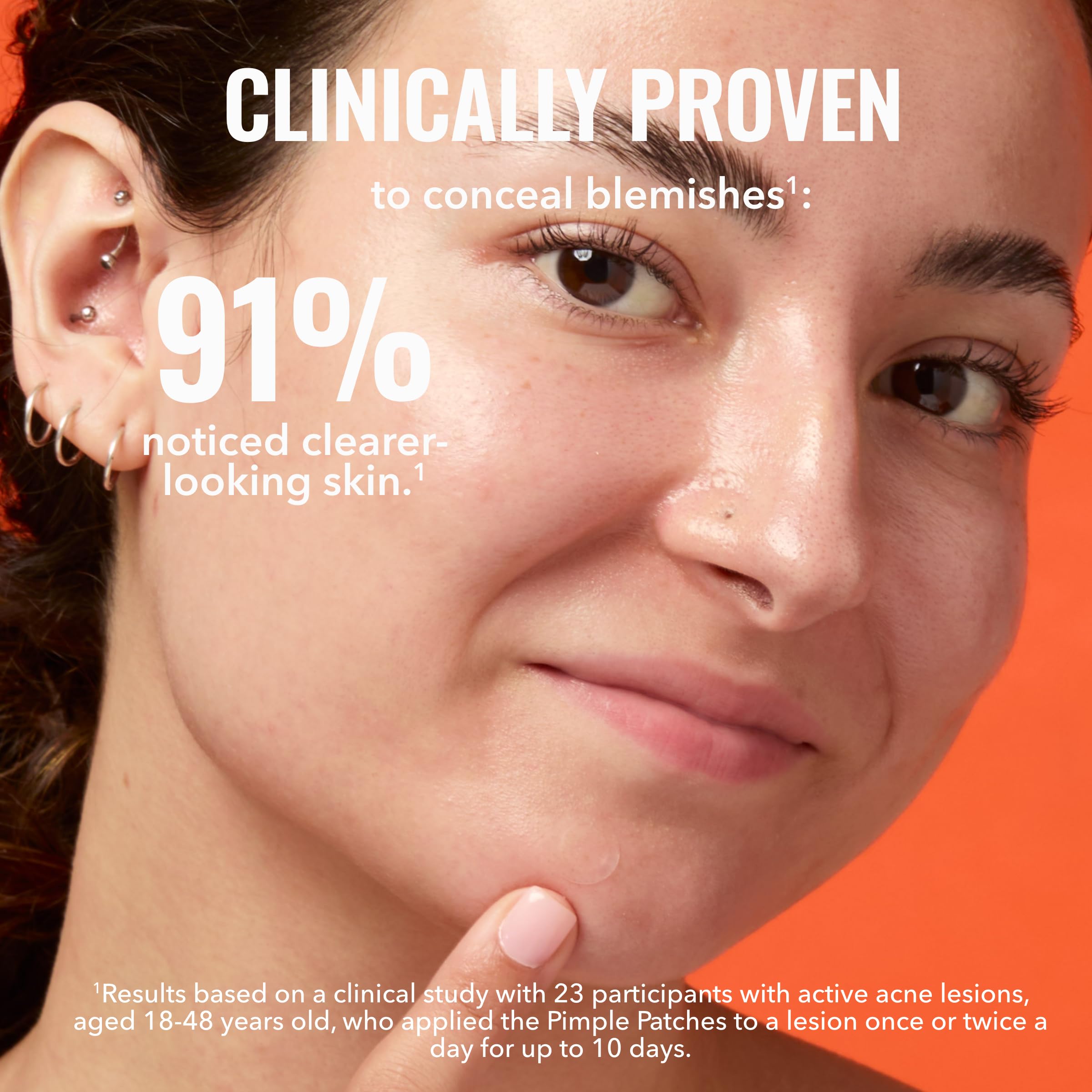 Good Molecules Pimple Patches for day and night application on a blemish.