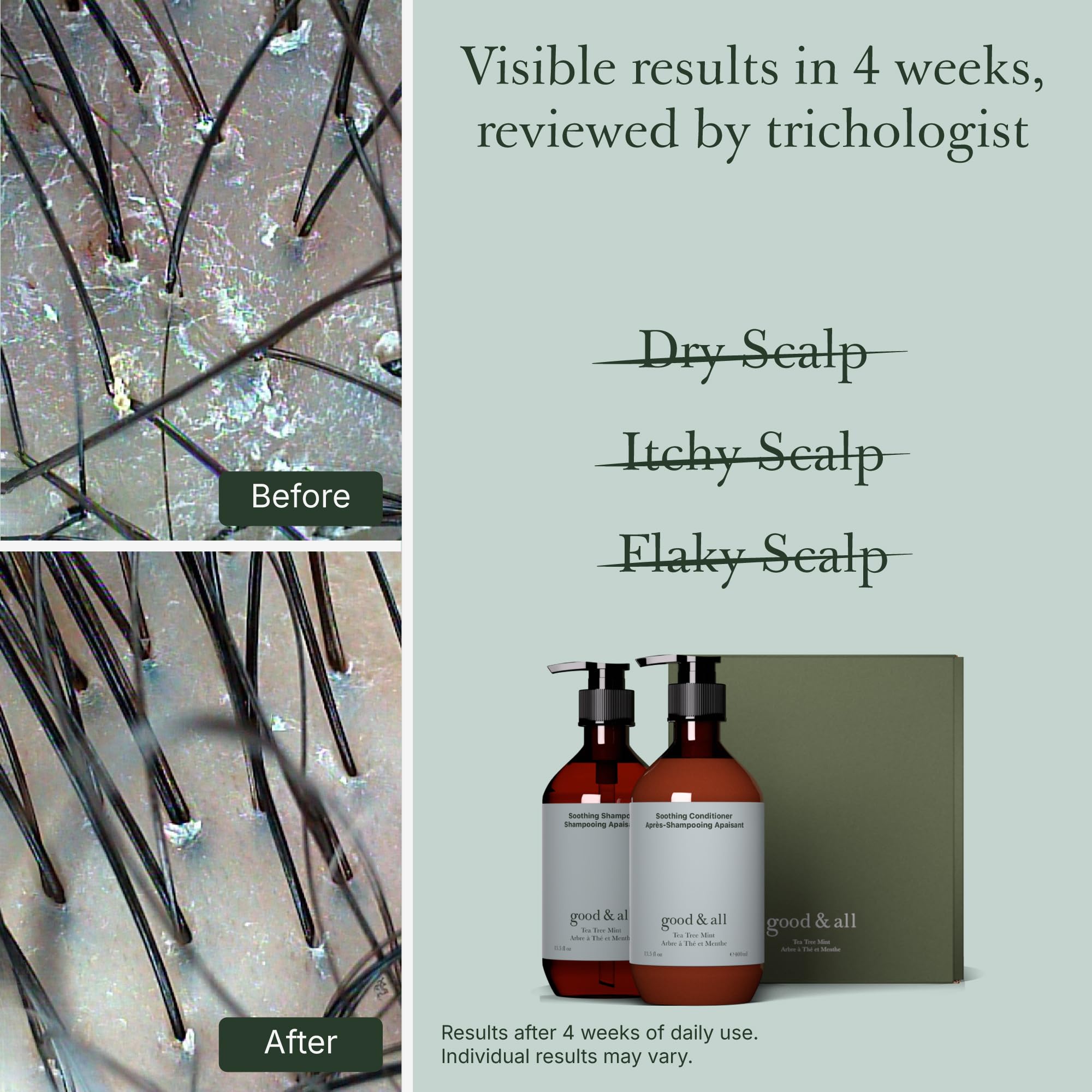 Good&All tea tree conditioner bottle nourishes dry scalp