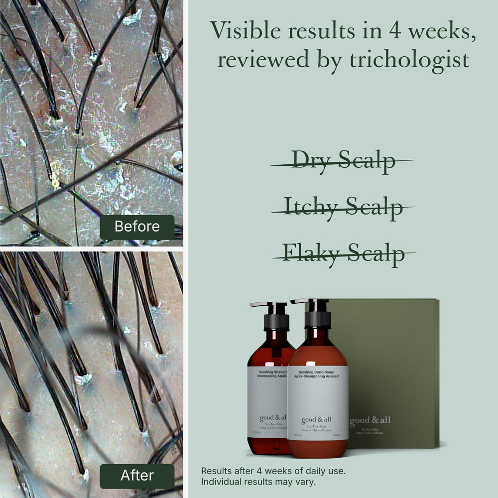 Good&All tea tree conditioner bottle nourishes dry scalp
