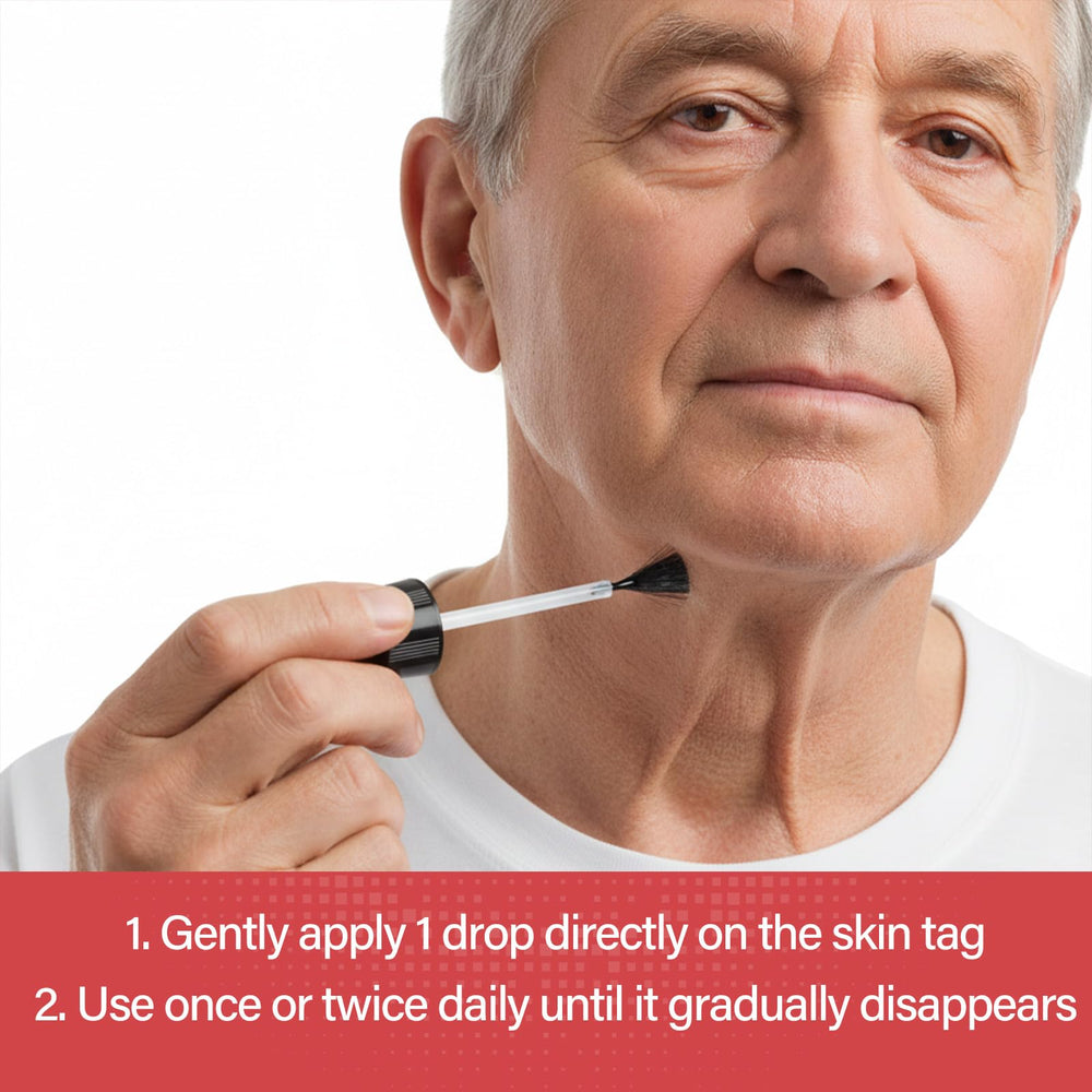 Goodnites Skin Tag Remover family-friendly solution suitable for multiple tags.