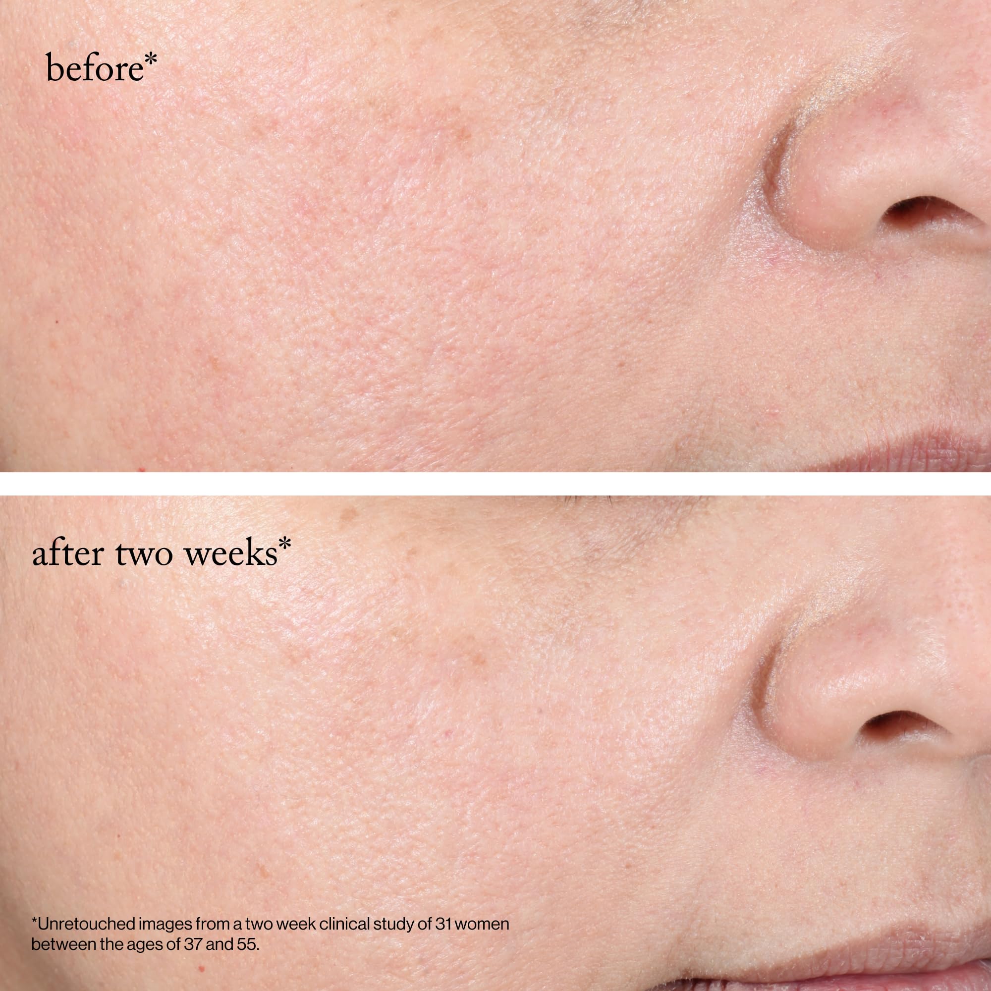 Goop Beauty 15% Glycolic Pads consumer results show smoother skin.