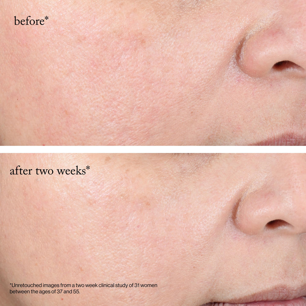 Goop Beauty 15% Glycolic Pads consumer results show smoother skin.