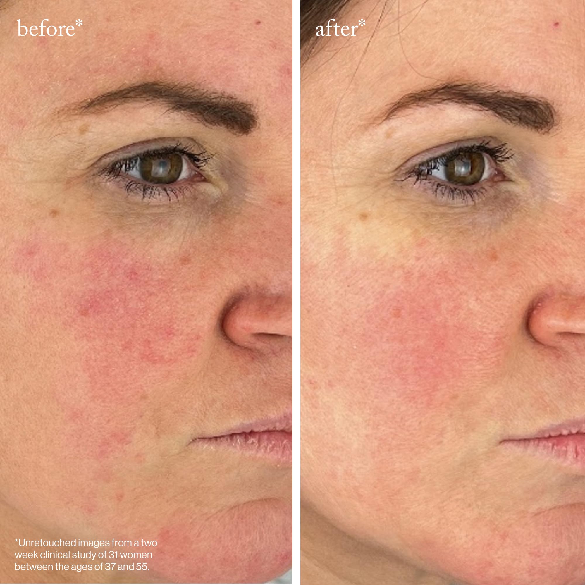 goop Beauty Serum on varied skin tones for radiant glow.