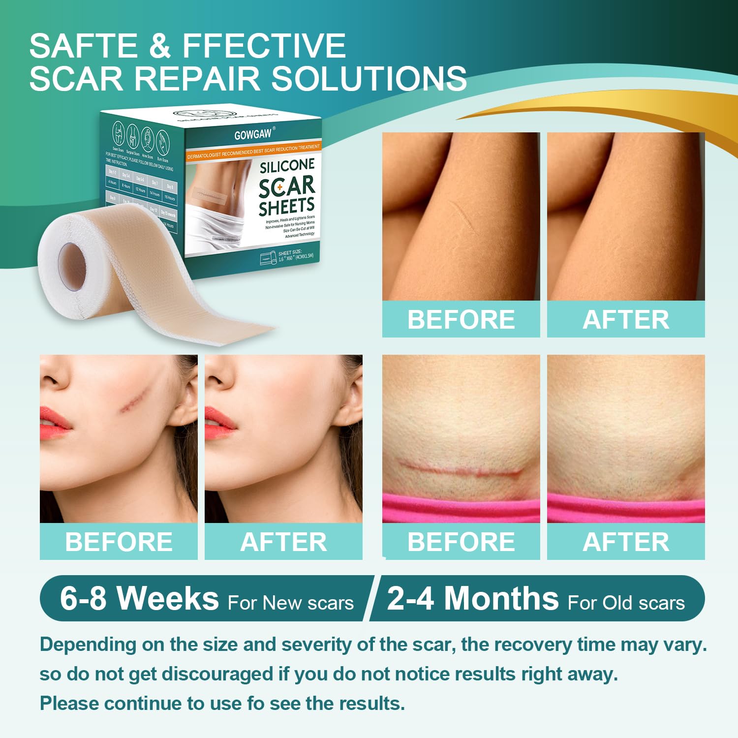 Gowgaw scar tape latex-free and safe for all ages