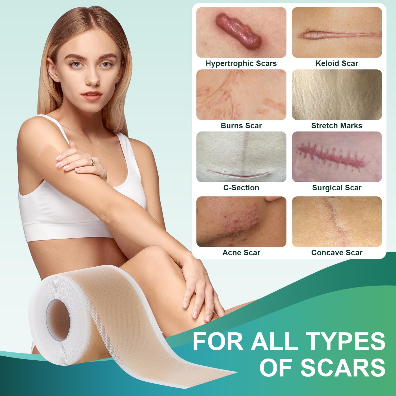 Gowgaw scar tape versatile for surgical, C-section, acne scars