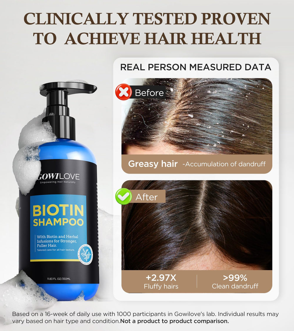 GOWILOVE Biotin Shampoo scalp-closeup features rosemary and menthol soothing scalp