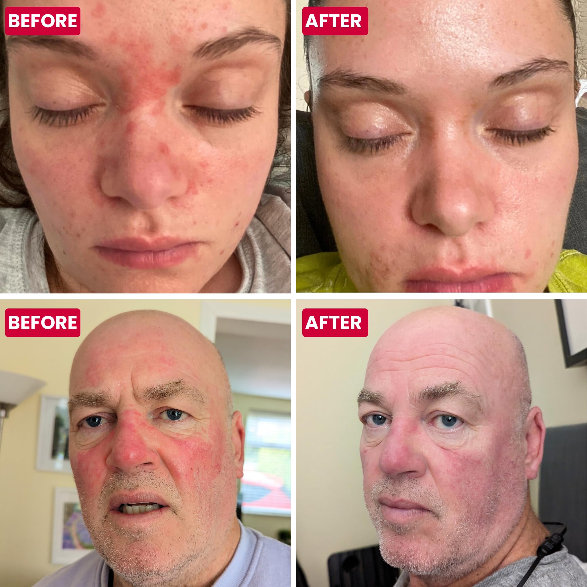 Grahams Natural niacinamide feature highlighting skin barrier support