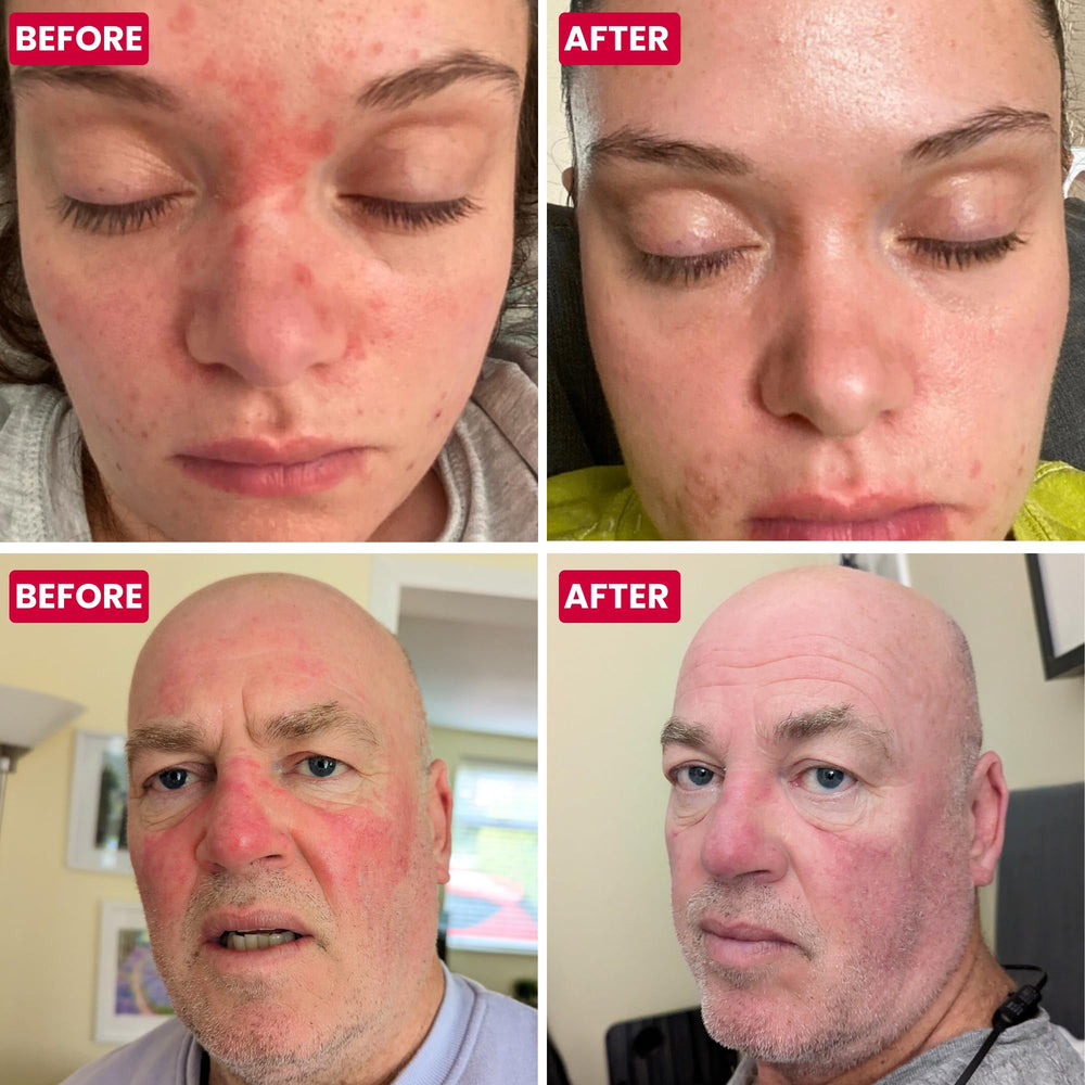 Grahams Natural niacinamide feature highlighting skin barrier support