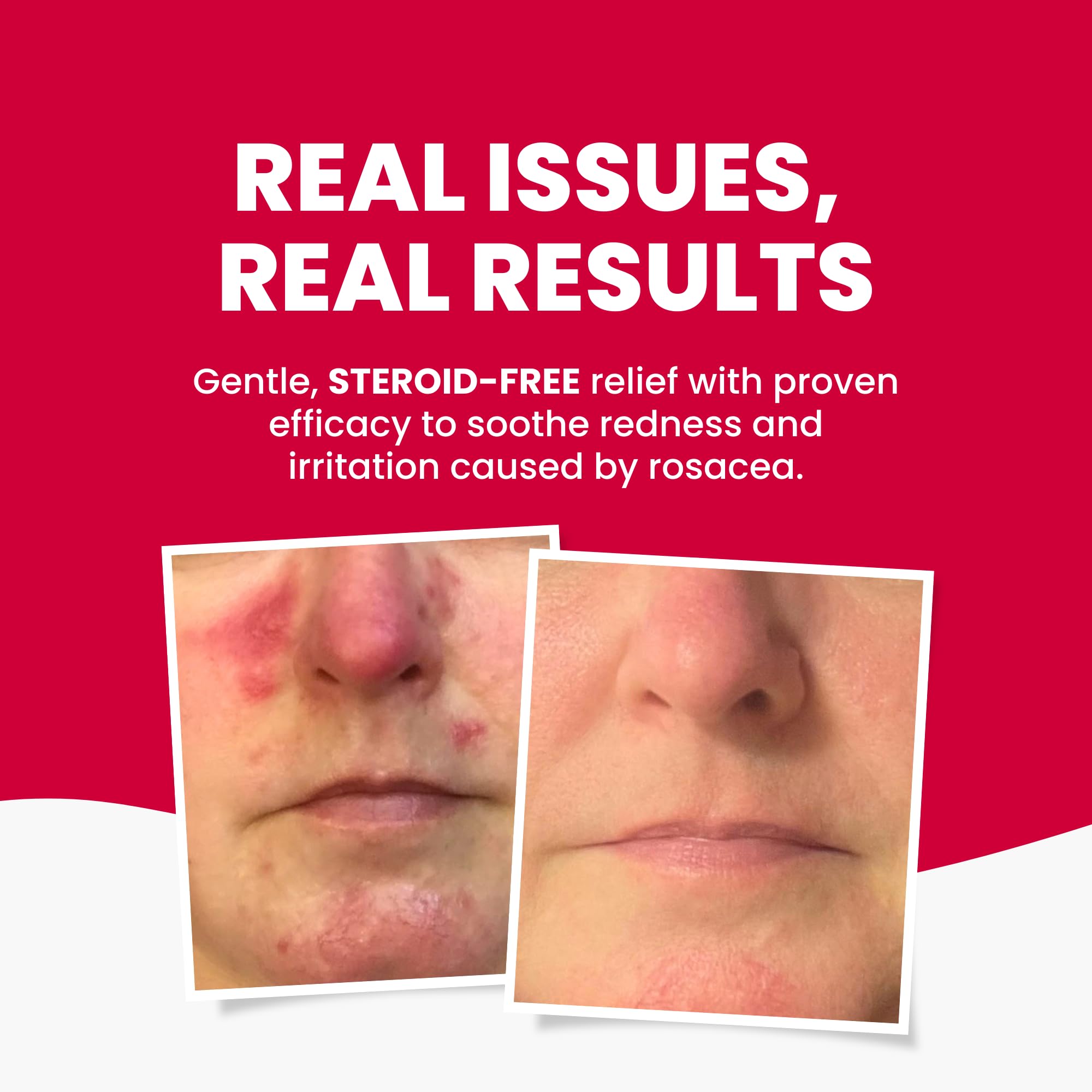 Grahams Natural Rosacea Cream label highlighting natural ingredients
