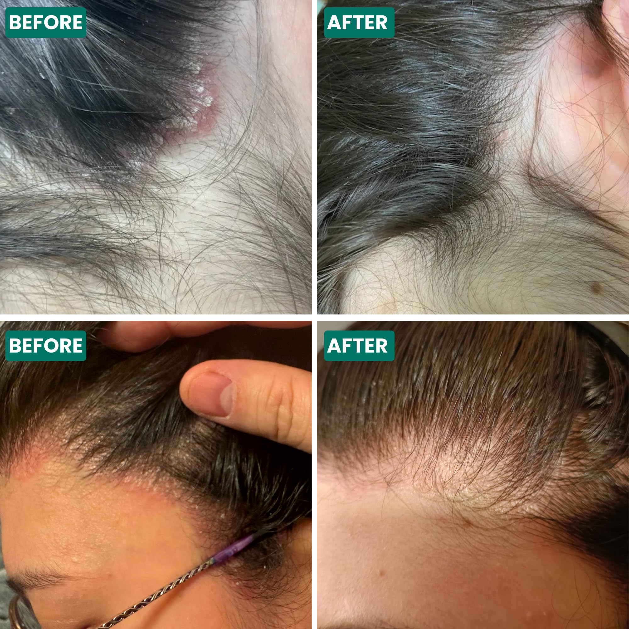 Grahams Natural Scalp Relief Oil nozzle application demonstrates targeted scalp care.