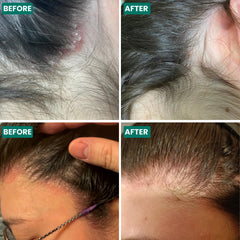 Grahams Natural Scalp Relief Oil nozzle application demonstrates targeted scalp care.