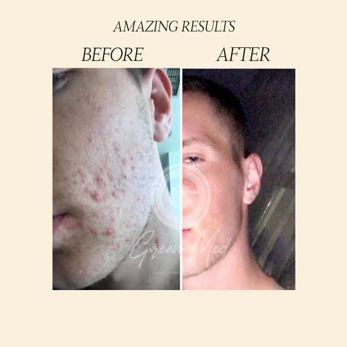 Green Med African Black Soap bar texture closeup emphasizing rich, purifying formula.