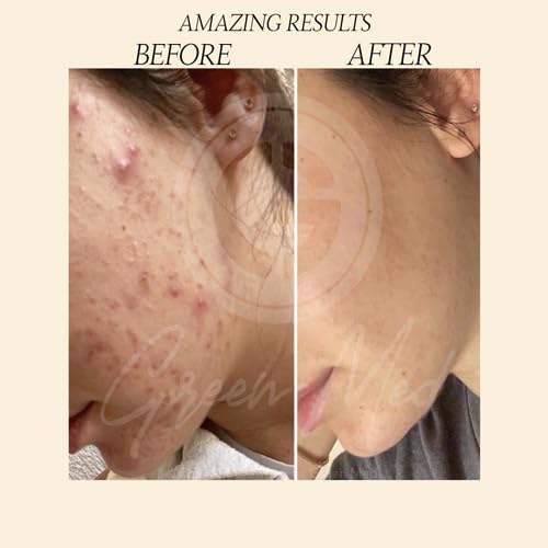 Green Med African Black Soap face use for refreshed, clear skin.