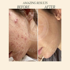 Green Med African Black Soap face use for refreshed, clear skin.