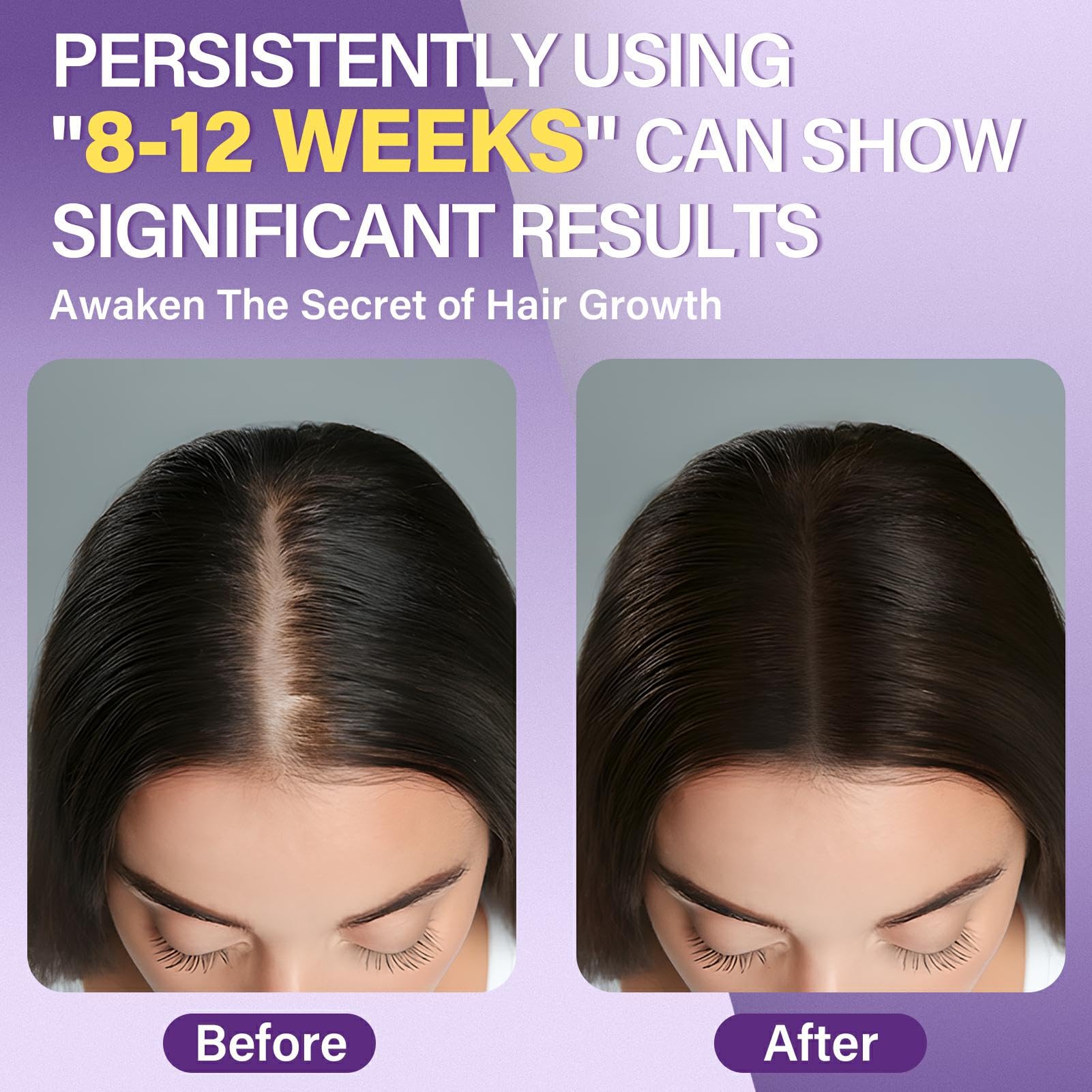Greoay foam dispense enables easy daily application to thinning areas.