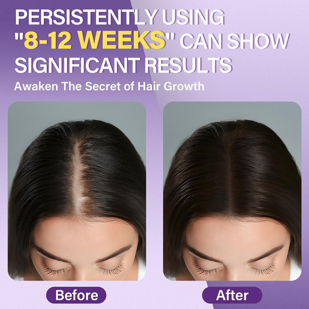 Greoay foam dispense enables easy daily application to thinning areas.