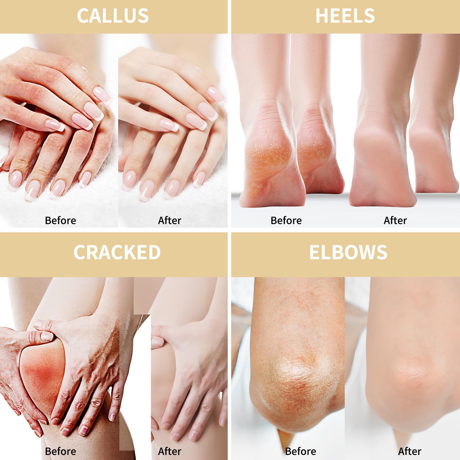 Grocerism Oat Urea Cream targets calluses for softer skin