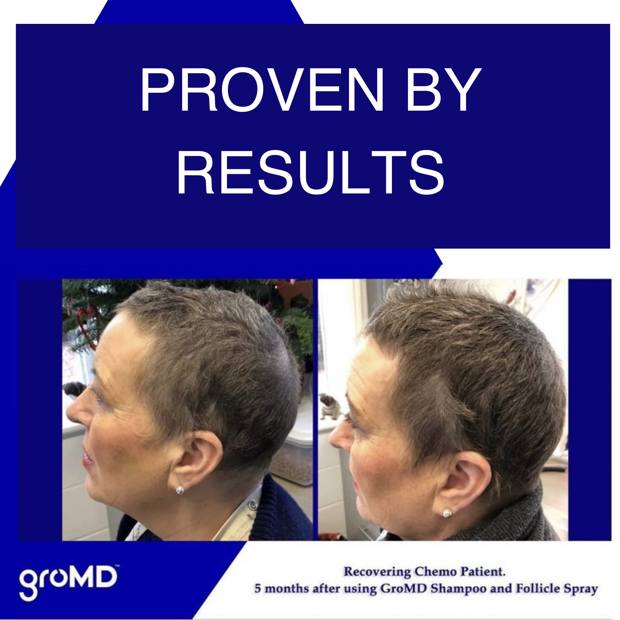 GroMD shampoo foam close-up showing rich lather for gentle cleansing.