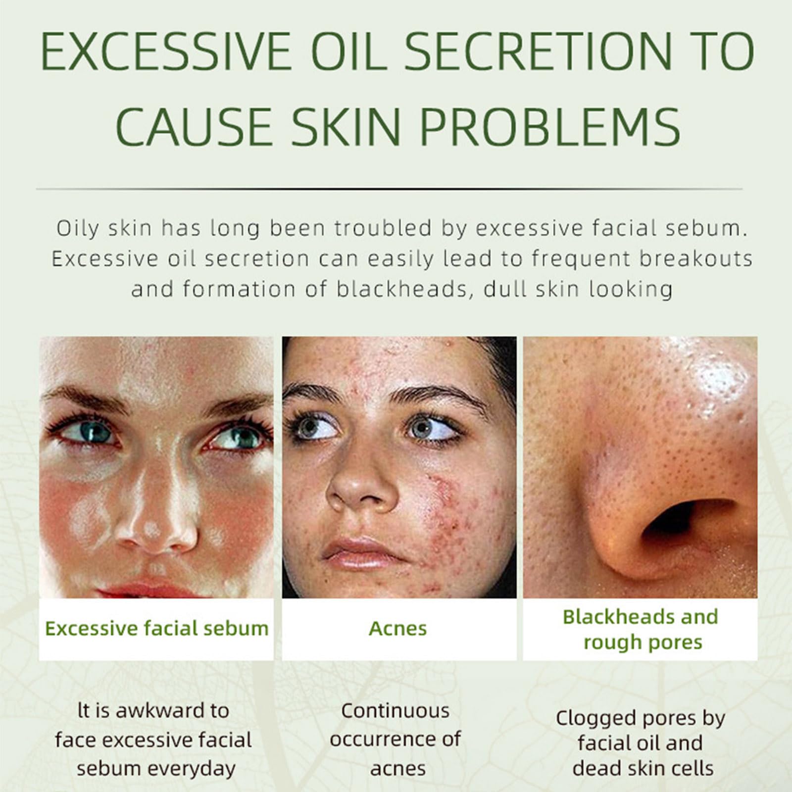 Grospe Herbal Acne Removing Cream jar shows rich texture for targeted spot care