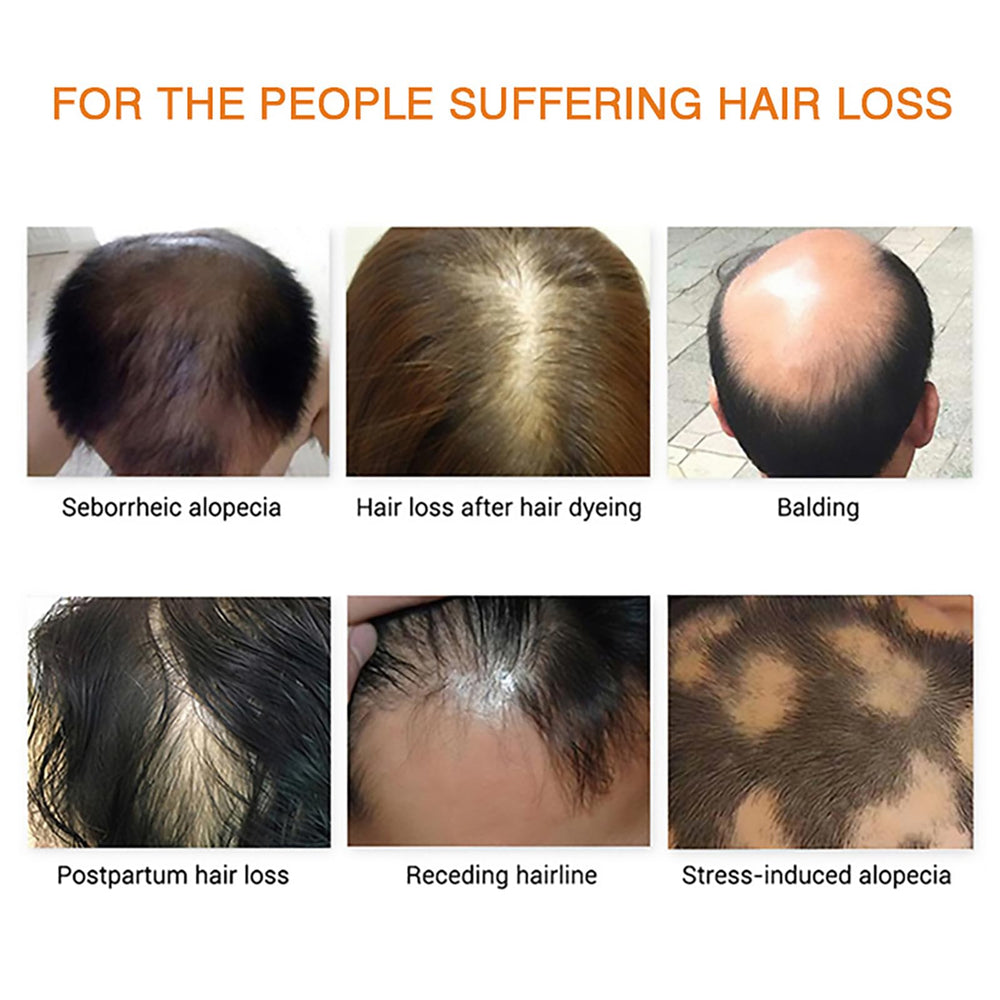 Grospe Hair Growth Essence Oil dropper illustrating deep root nourishment for healthier hair
