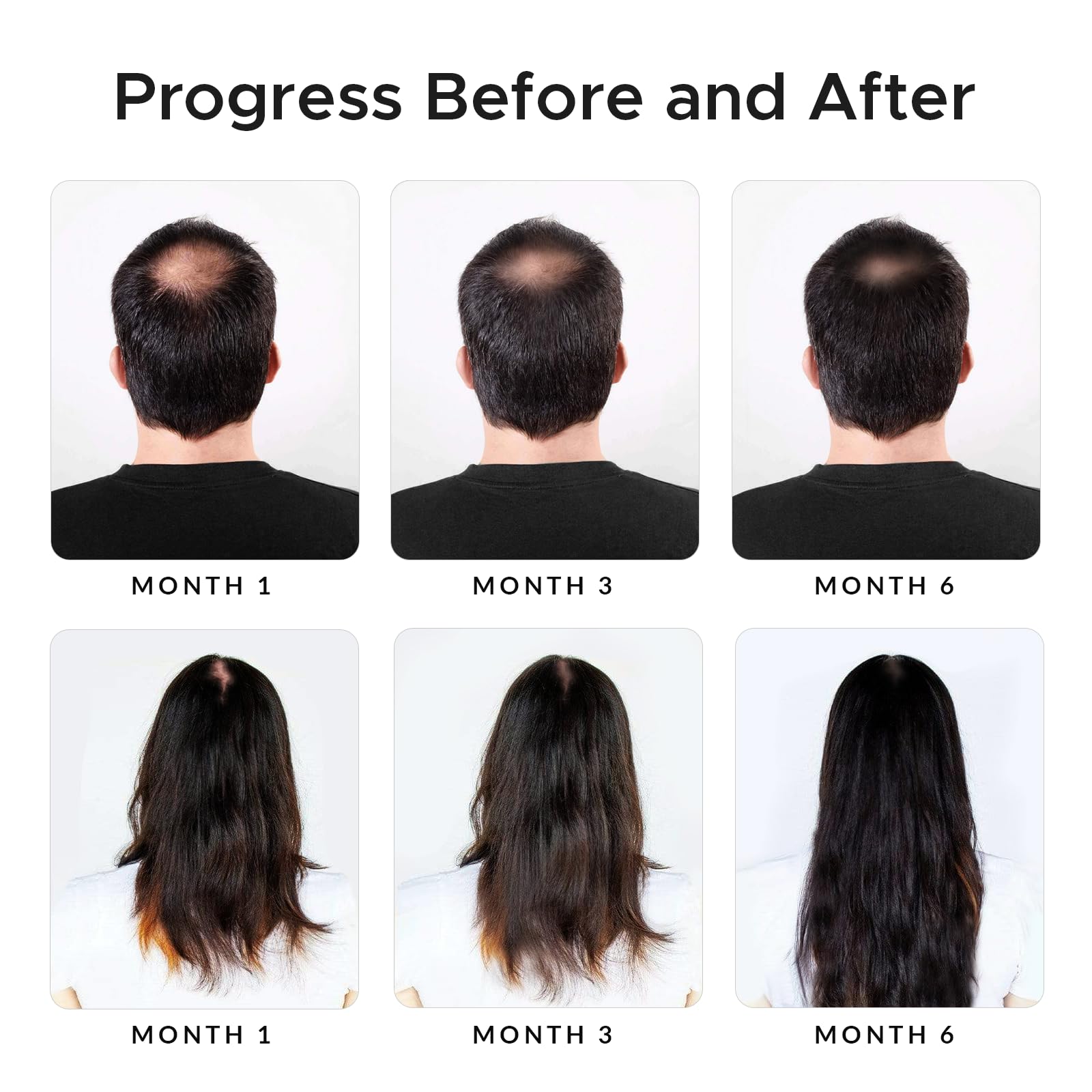 Onion extract visual emphasizes traditional scalp care in Growth Essence formula