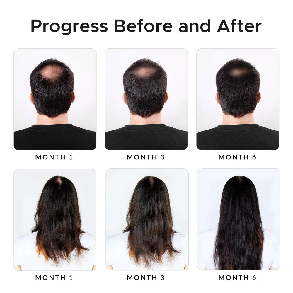 Onion extract visual emphasizes traditional scalp care in Growth Essence formula
