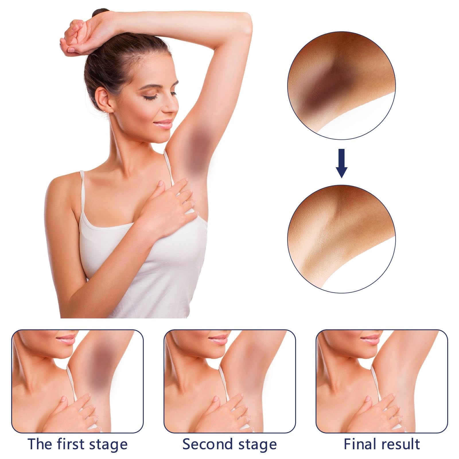 Gukei knees and elbows spot treatment targets uneven tones with care.