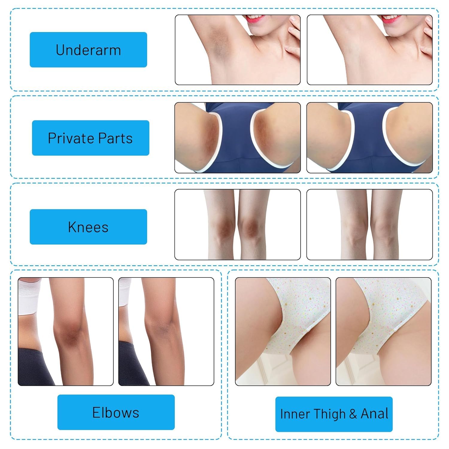 Gukei bikini area gel for intimate zones