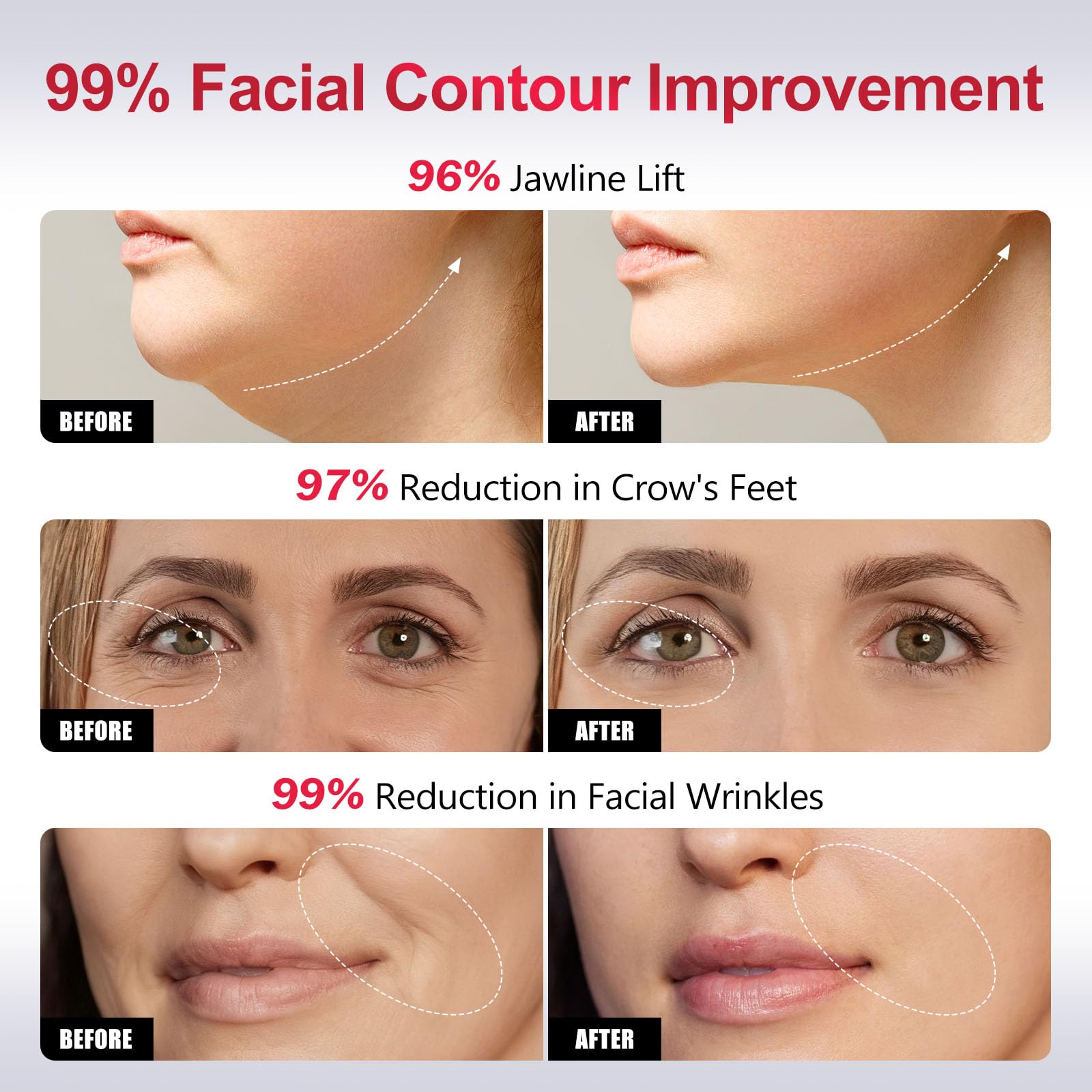 Gunfay EP-300 elasticity boost improves skin resilience and bounce.