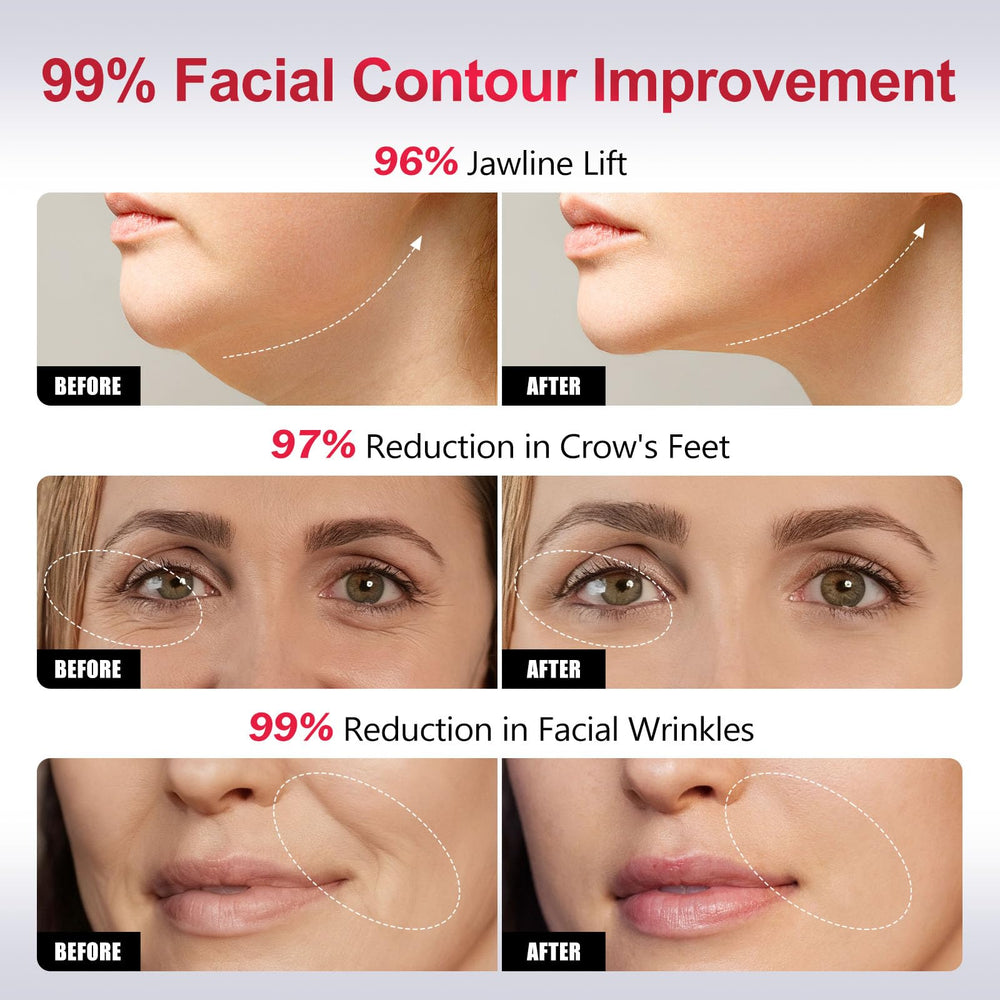 Gunfay EP-300 elasticity boost improves skin resilience and bounce.