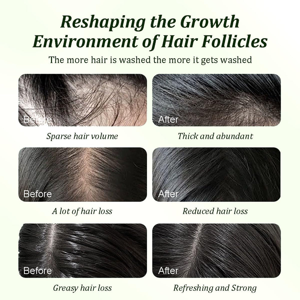 Gypsophila shampoo suitable for all hair types, including sensitive scalps.