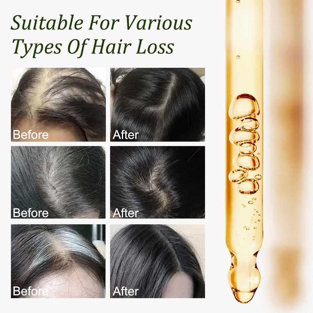 Scalp massage with Gypsophila Batana Oil for healthy roots.