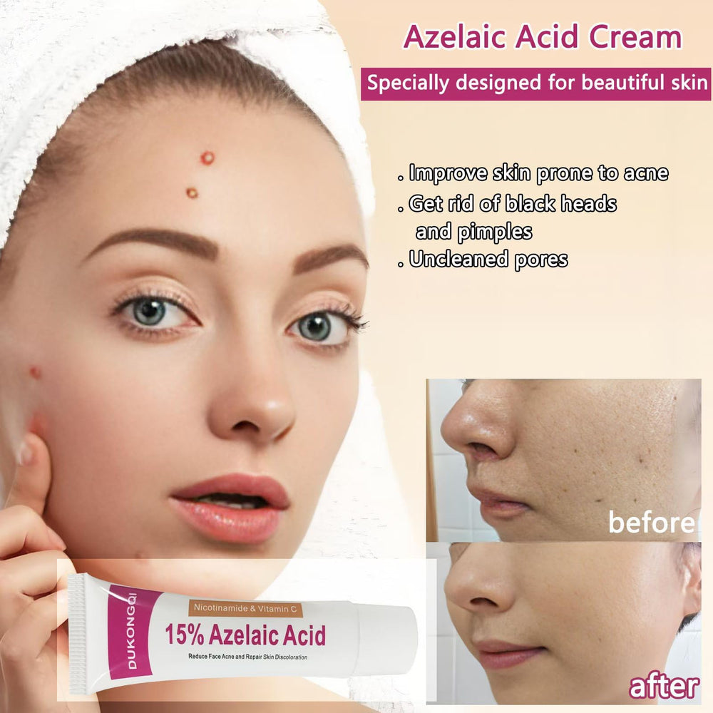 Gzchaox azelaic acid cream 15 fresh skin after application and hydration.