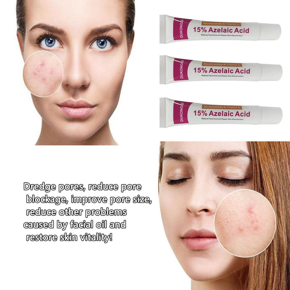 Gzchaox azelaic acid cream 15 pore care visible improvement in texture.