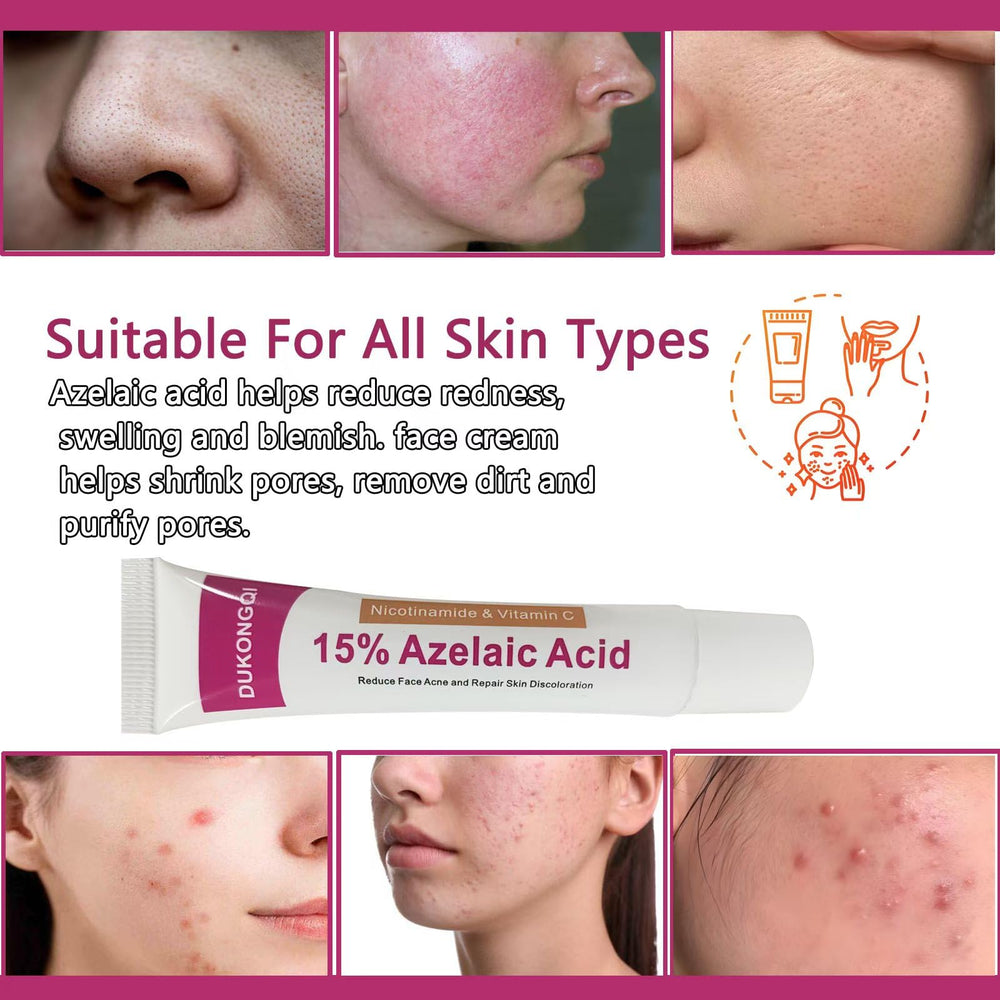 Gzchaox azelaic acid cream 15 redness relief for sensitive facial skin.