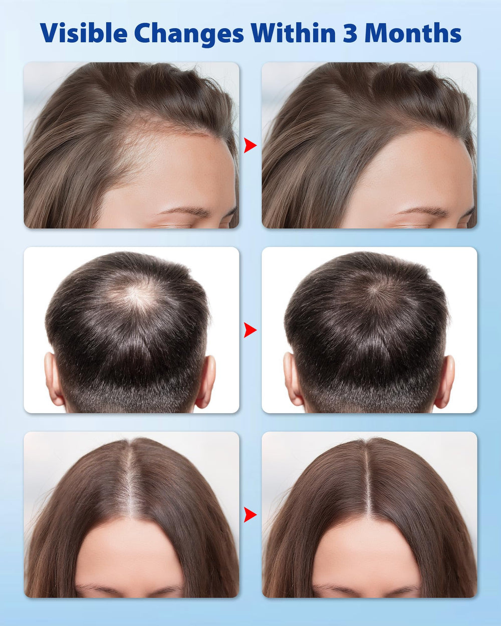 HACIRJNG formula suitable for all hair types and genders.