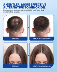 HACIRJNG Hair Growth Serum Roll-On close-up for targeted thinning area treatment.