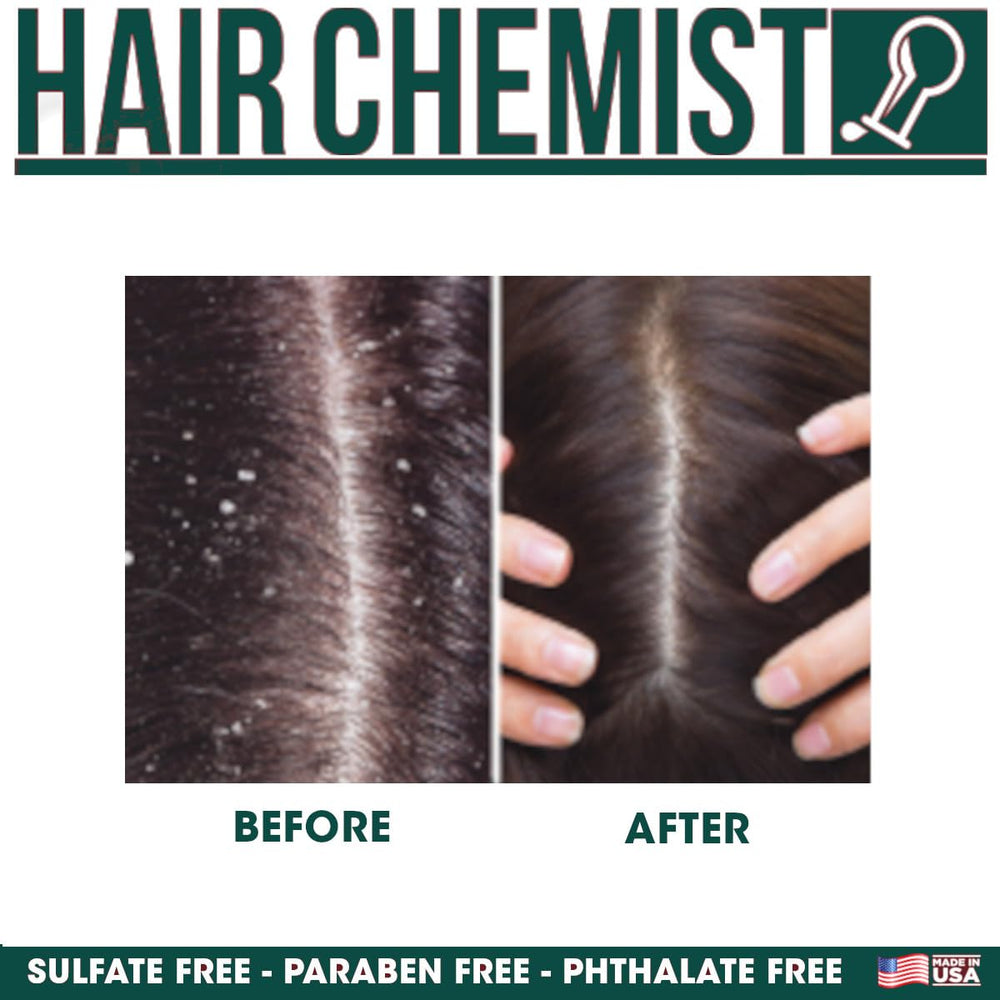 Hair Chemist scalp stimulator anti-itch close-up demonstrating soothing relief