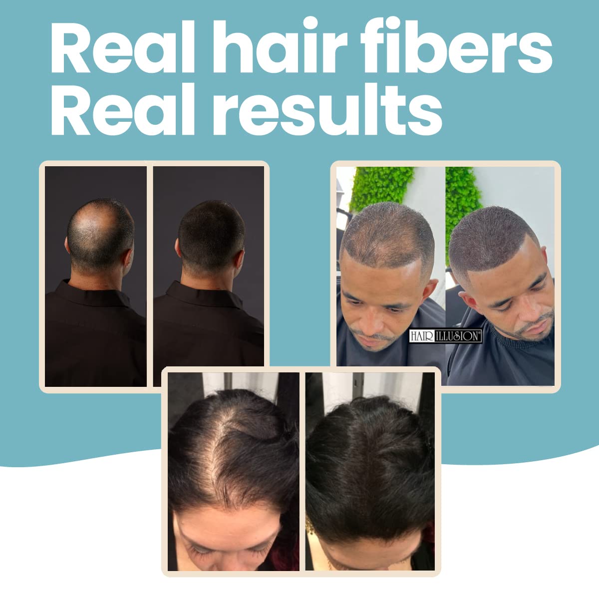 Hair Illusion applying on thinning area to create a fuller silhouette