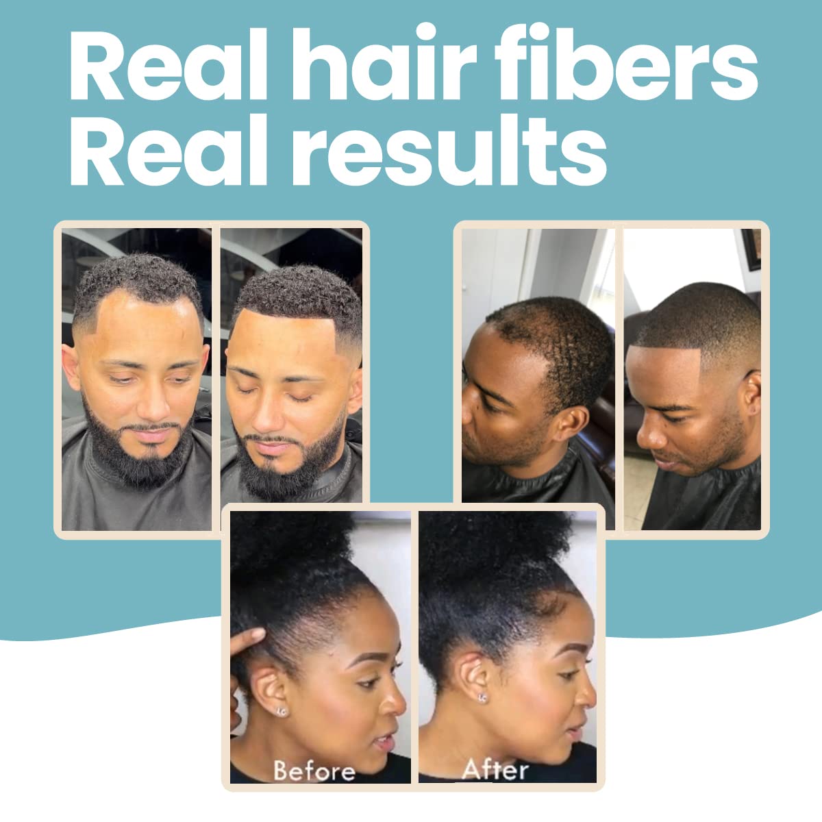 Hair Illusion coverage demo over a scar area with discreet blending.
