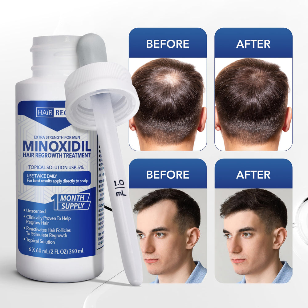 Hair Regen daily-use routine supports consistency for men.