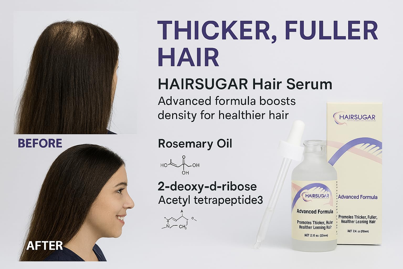 Hair Sugar scalp close-up applying serum targeting thinning areas for potential improvement.