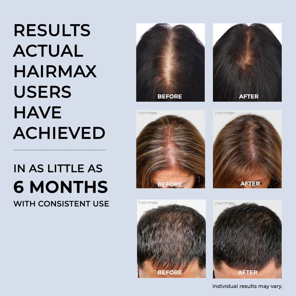 HairMax Laser Band 41 back view highlighting ergonomic, cord-free operation.