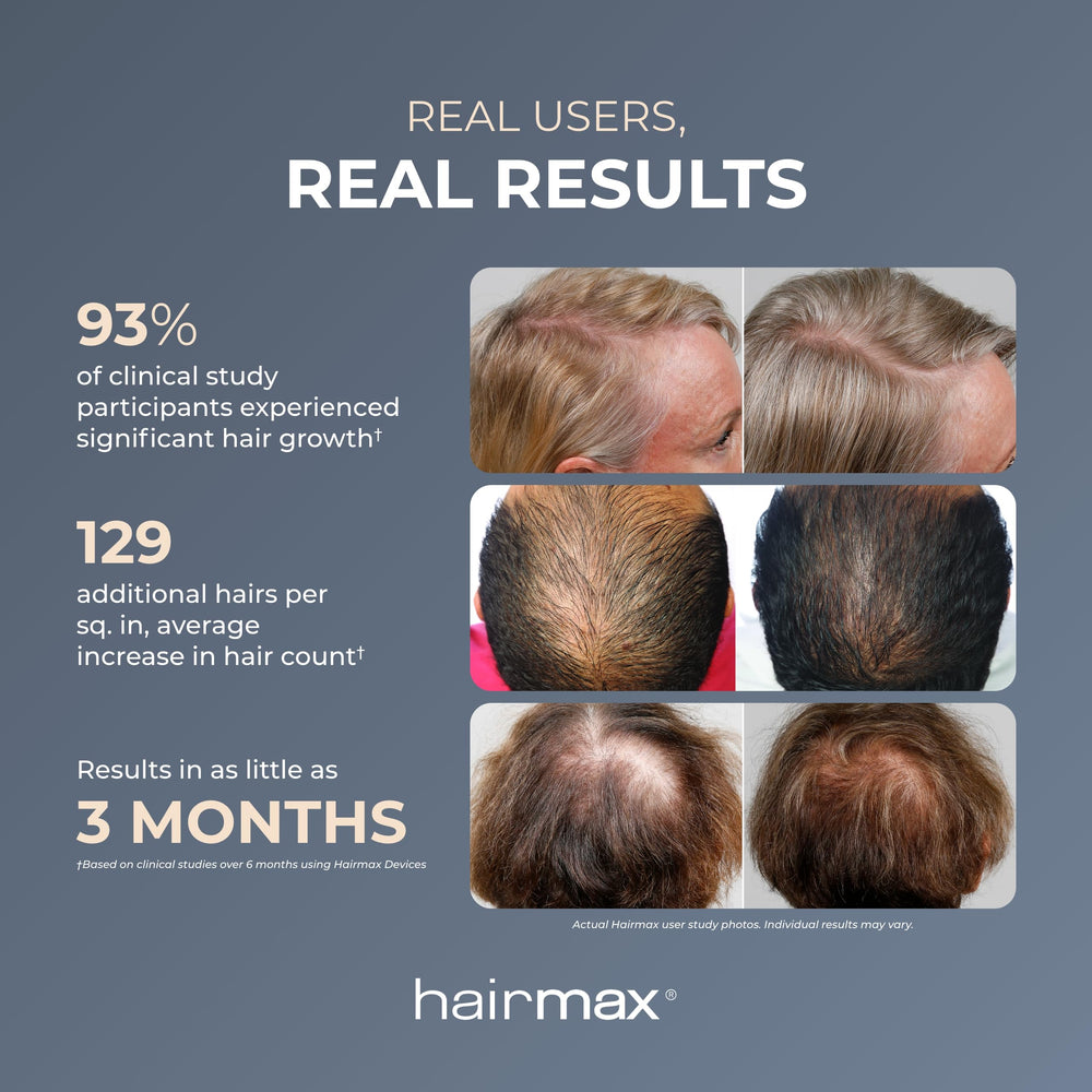Hairmax Ultima 9 Classic cordless design for easy home sessions