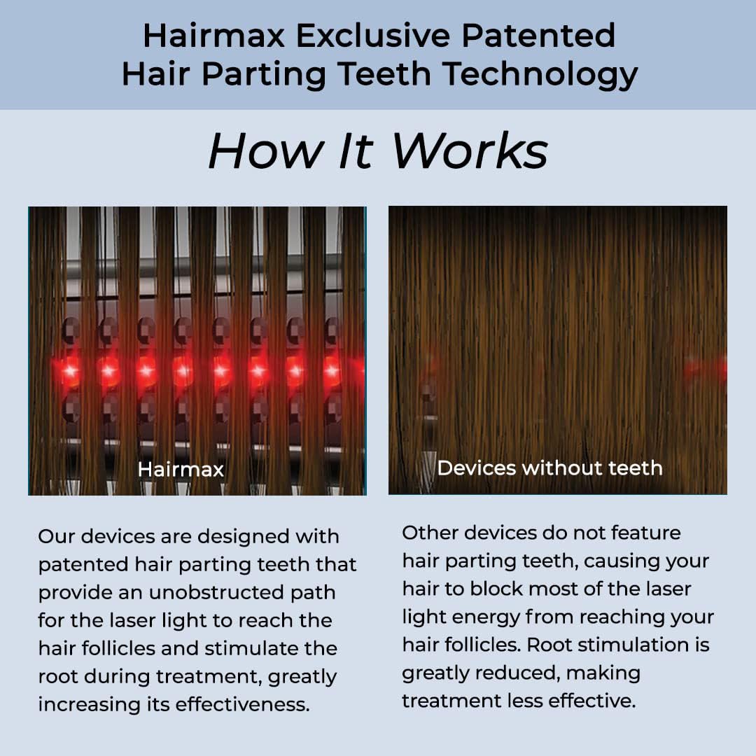 HairMax Ultima12 device delivering fuller-looking hair density with consistent use.